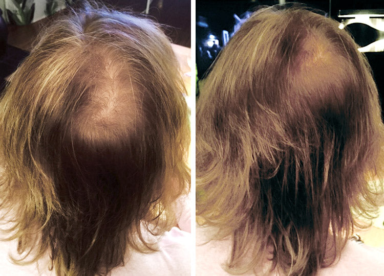 Før- og efterbillede ved brug af Hair Grow