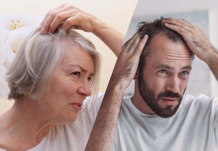 Hvorfor har jeg tyndt hår?