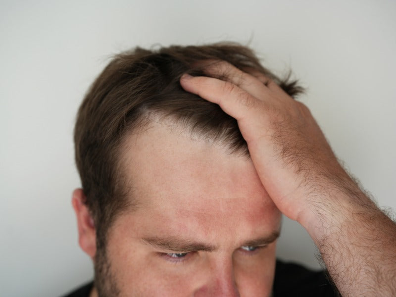 Hårvækst for mænd over 50