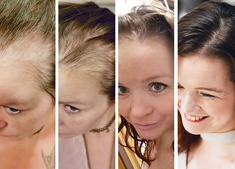 Sabrina har oplevet fordelene ved brug af Hair Grow