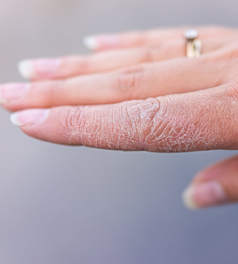 Wellvita Siff Dry Skin.